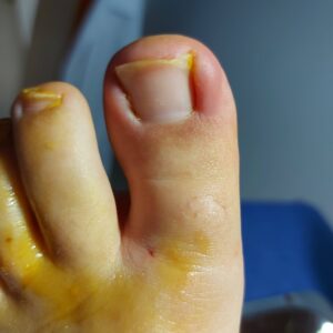 20201005_165224