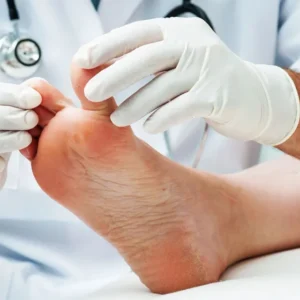 CONSULTA MEDICA PODOLOGICA